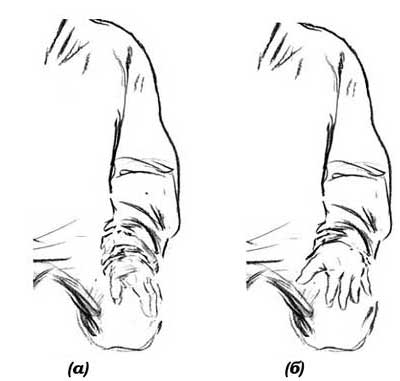 Рис.72. Положение левой руки во время попеременного дыхания